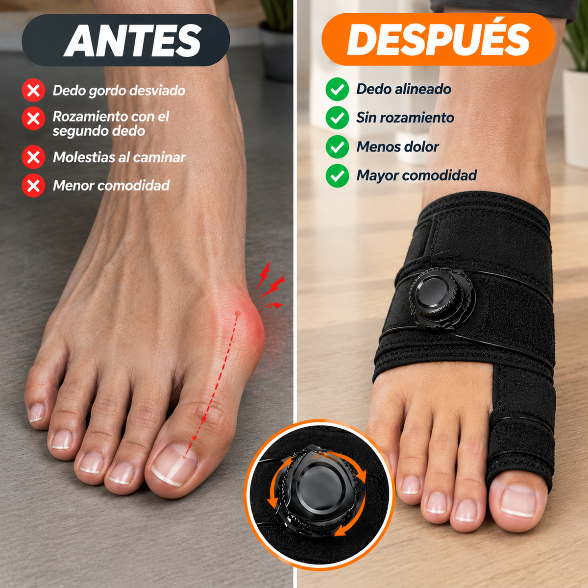 BuniFlex — Corrector y separador de dedos para el cuidado diario de tus pies.